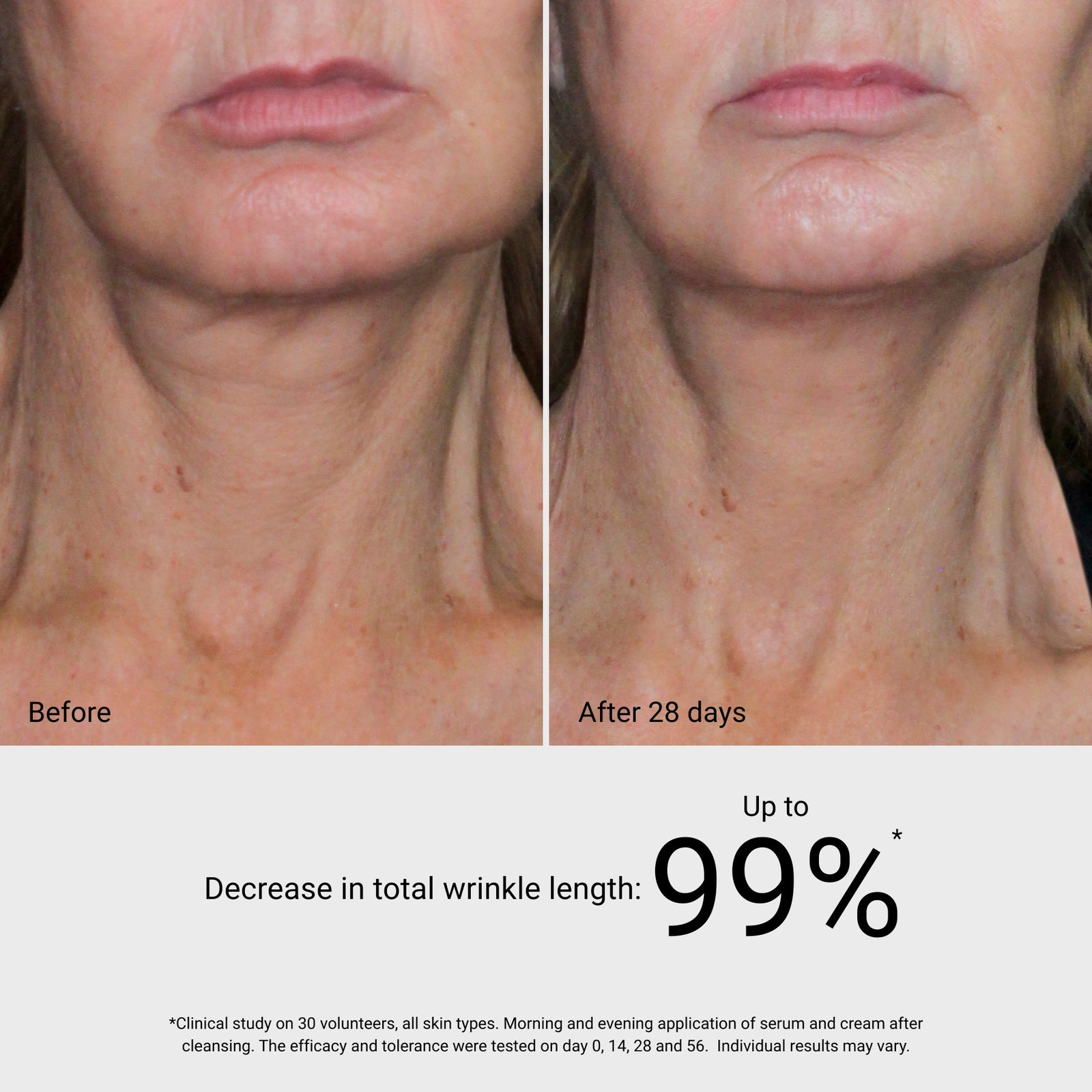 4D Visible Lifting Serum - Improves Skin Tone | GM Collin