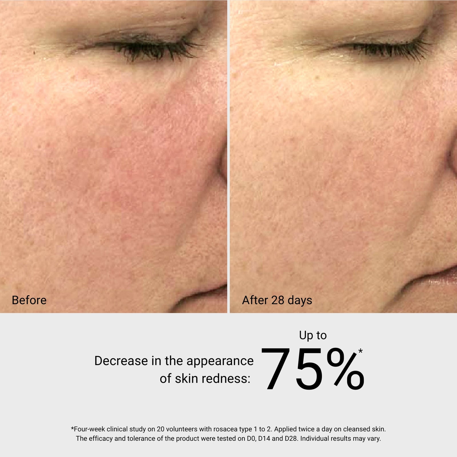 Rosa Sea Gel - Reduces Redness & Discomfort | GM Collin